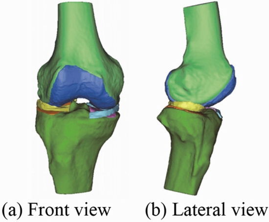  joint segmentation-rigid registration - Application to motion estimation of human knee {faces}